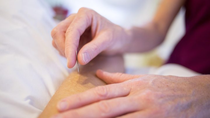 Dry Needling kann Muskelverspannungen lösen und Schmerzen lindern. Erfahre, wie diese Methode gezielt Triggerpunkte behandelt und die Beweglichkeit verbessert.