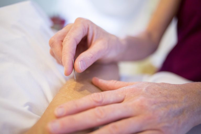 Dry Needling kann Muskelverspannungen lösen und Schmerzen lindern. Erfahre, wie diese Methode gezielt Triggerpunkte behandelt und die Beweglichkeit verbessert.