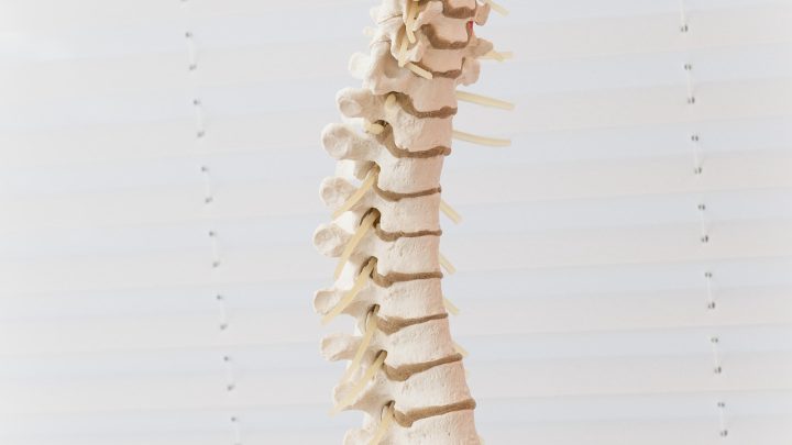 Physiotherapie bei Morbus Bechterew hilft, Versteifung vorzubeugen und Schmerzen zu lindern. Erfahre, welche Übungen deine Wirbelsäule mobil halten.
