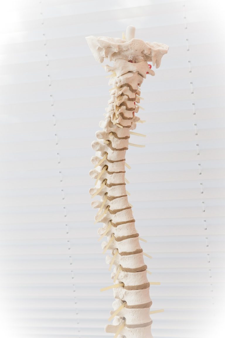 Physiotherapie bei Morbus Bechterew hilft, Versteifung vorzubeugen und Schmerzen zu lindern. Erfahre, welche Übungen deine Wirbelsäule mobil halten.
